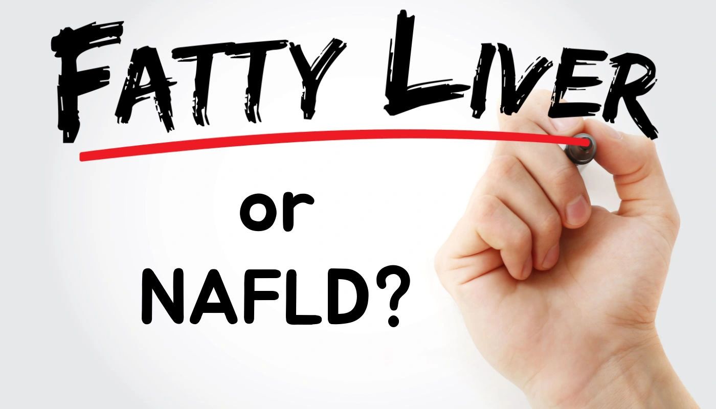 Fatty Liver Of NAFLD fatty-liver-of-nafld
